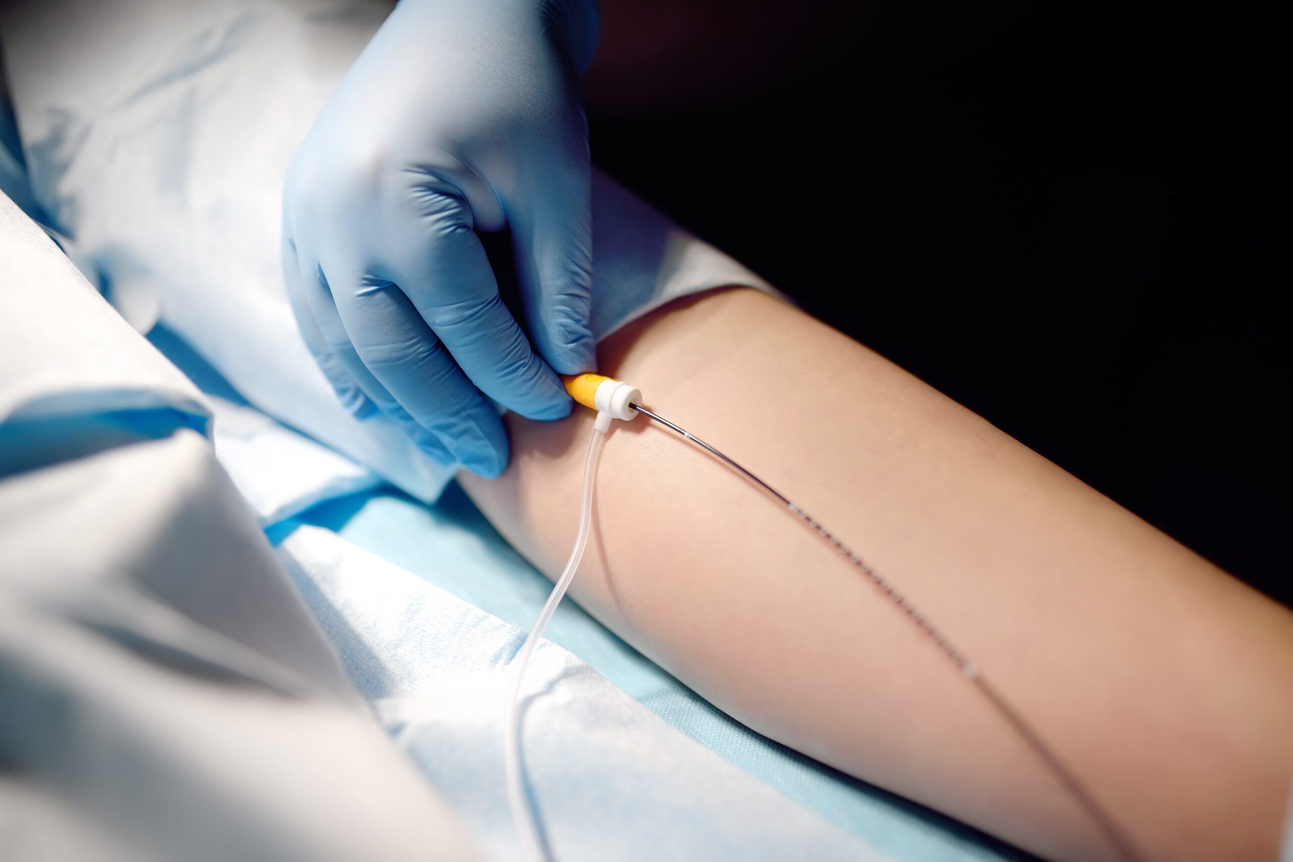 Endovenous Ablation Tampa Florida Safety Harbor Florida