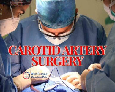 Carotid Artery surgery and its role in stroke prevention