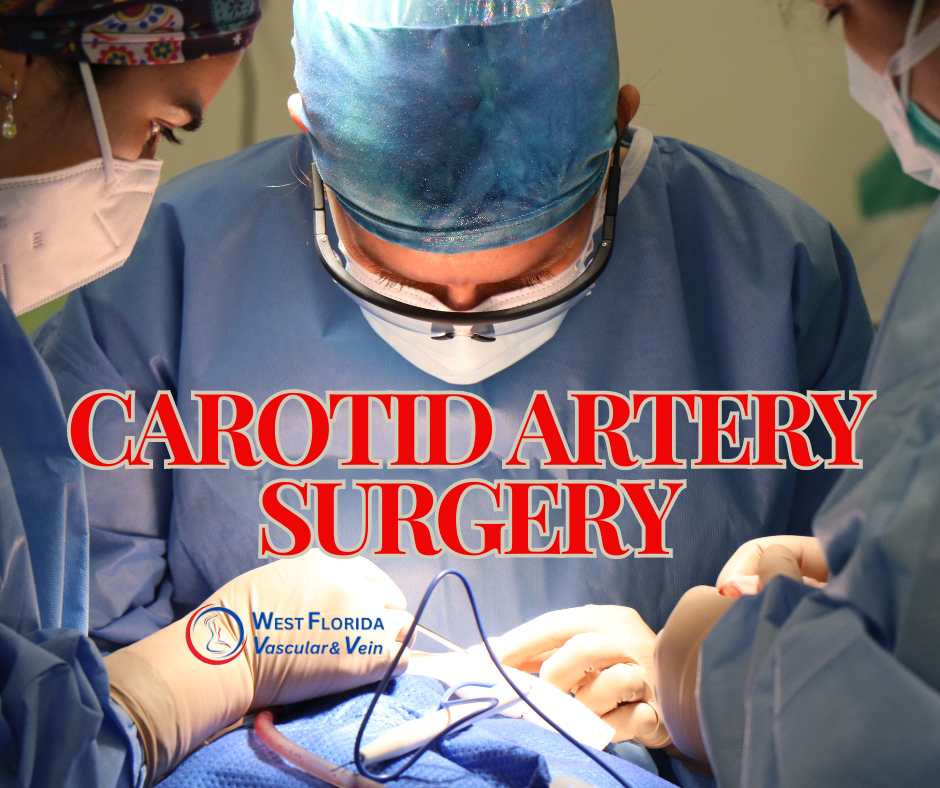 Carotid Artery surgery and its role in stroke prevention