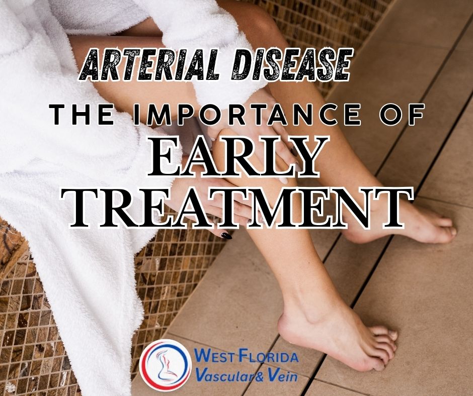 The Importance of Early Detection and Treatment of Arterial Diseases west florida vascular and vein