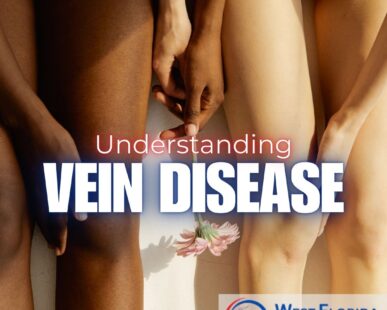 Understanding Vein Disease symptoms West Florida vascular and vein