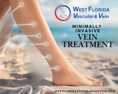 Minimally Invasive vein treatment tampa safety harbor